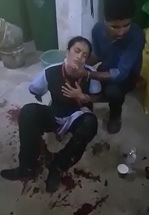 Female Worker in Shock after Losing Arm in Horrific Work Accident