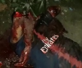 Hacked Up with Machete Trying to Cover his Face with Arm Dangling