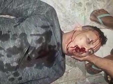 Final Stare Before Death