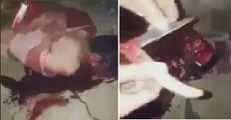 Absolutely Brutal Stabbing (Multiple Punctures and Slices)