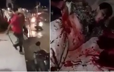 Cowboy Hat Wearing Machete Man Carves Up Rival