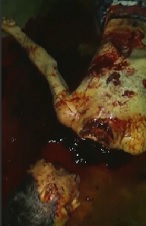 Prison is Much Worse in Some Countries