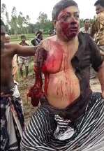 Heavyweights Arm Ripped Off (HD Aftermath)