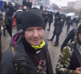 Paris Protester Gets Gas Grenade Shot Into His Eye