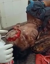 Trying to Repair Woman Ripped Up by Bear