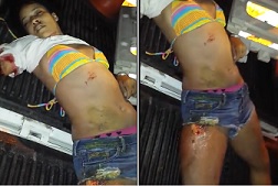 Pretty Girl Dies... Arm Ripped Off