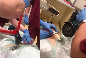 Morons Cock Ring vs. Saw & Bolt Cutters