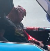 Drug Wars Leaves Dude Looking Like Sloth From Goonies