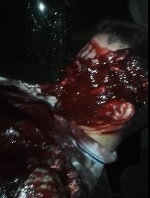 Bloody Mess... Pretty Bad Day... Last Breath!!!