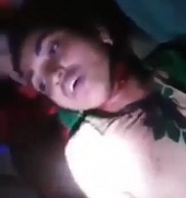 Dying Girl with her Throat Slit.