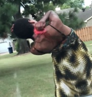 HOLY SHIT: Meth Zombie Scratches and Rips Her Skin Off