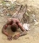 Copper Cable Thief Got a Little Toasty