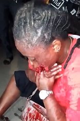 Cops Shoot Woman in the Mouth. (Clean Version)