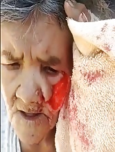 Pitbull Attacks Elderly Woman.