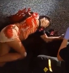 Chicks Shoulder is FUCKED Up.