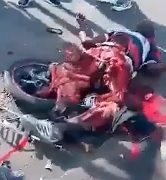 YIKES! Man Cut in Half & Still Alive.