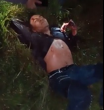 Man Got Hand Chopped Off & Left In The Street