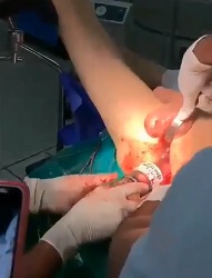 Now That's the Corona Virus.