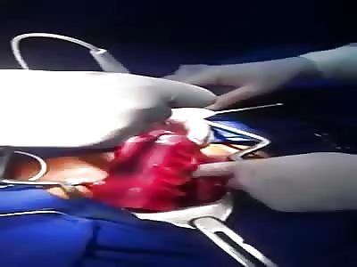 Removing deodorant  the anus of an inmate