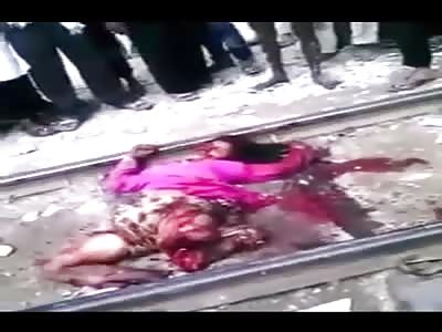 failed suicide woman lost both legs in train lines