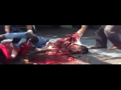 Remove body of a motorist with exposed viscera