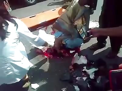 Biker skull shattered in accident