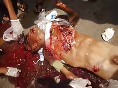 Cyclist completely disfigured after being hit by a bus