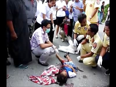 Little dead girl in atropello