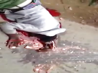 Pedestrian head crushed by a truck