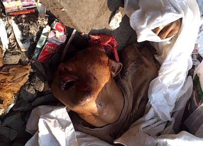 Remains of a suicidal man on the train lines