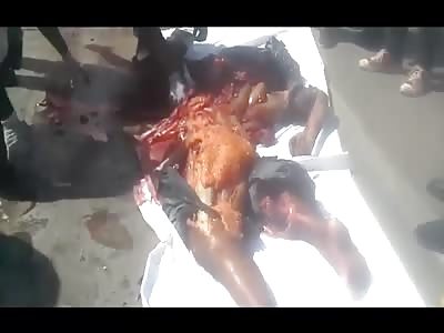 Motorcyclist completely dismembered in accident