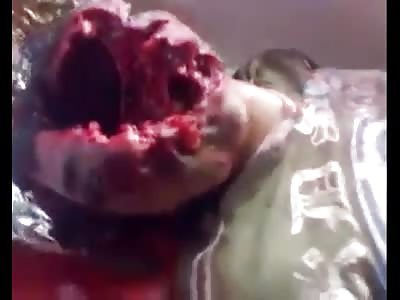 Body in the morgue with his face disfigured