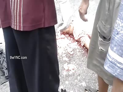 Brain scattered accident