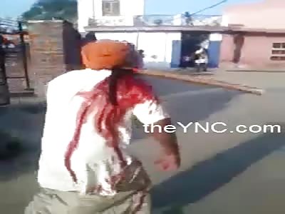 Man wounded with a mattock embedded in his shoulder