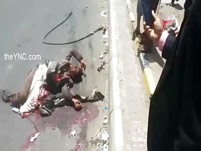 Man crushed by a truck still alive