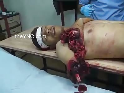 man with his arm severed gives moans of pain