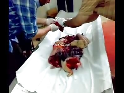 Put together the parts of a body ripped to pieces by Granada