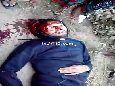 Agony of a man after being shot in the eye