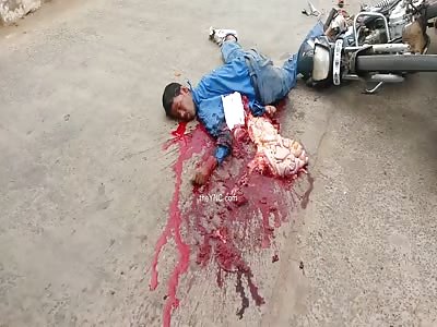 Heart Beat Out Of A Man Crushed By A Truck