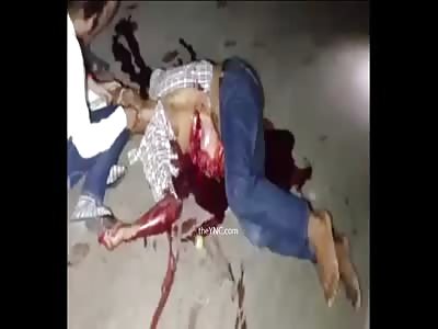 The Man With Exposed Viscera Was Died By A Car