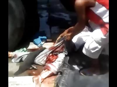 The Man Was Crushed And Killed By A Truck