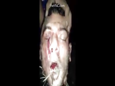 Man Is Murdered & Dismembered By Drug Dealers