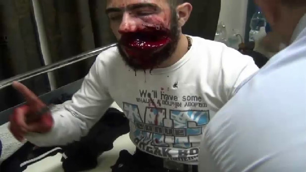 Machete Blow In The Face - Allahu Akbar !