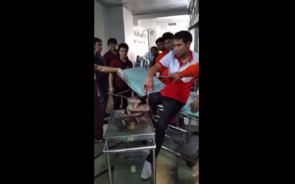 Remove The Hand Of A Man Crushed In A Machine