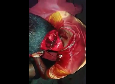 Man Seriously Injured By Machete Blows