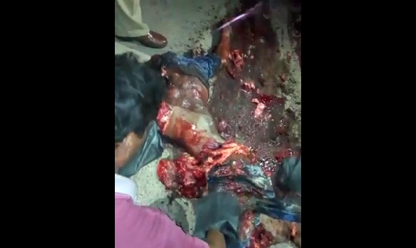 Man Dead Completely Ripped To Pieces By A Truck