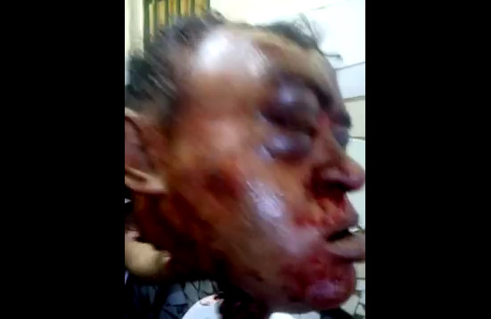 Prisoners Have Fun With The Beheaded Head Of A Rapist