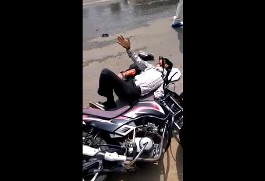 Man Motorcyclist Stays Alive With The Severed Leg 