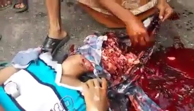 Collect The Brain Scattered Of A Dead Man On The Street  