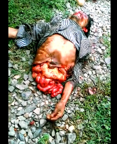 The Man Was Split In Two By A Train